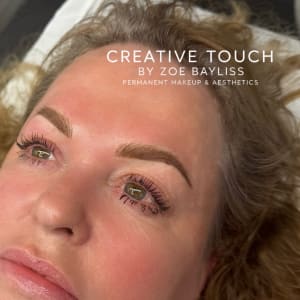 Healed combination ombré brows with hair strokes at bulb showing enhanced definition and symmetrical shape despite scar above tail on fair skin