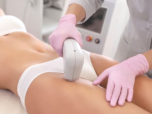 Client undergoing bikini line hair removal treatment