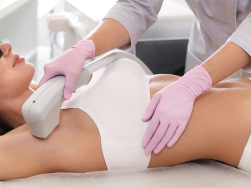 Client undergoing underarm laser hair removal treatment