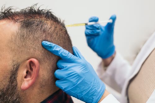 A male client receiving PRP Hair Treatment in an aesthetics clinic. The aesthetician can be seen injecting blood plasma into the man's scalp