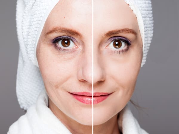 Before and after skin rejuvenation - split portrait of a middle-aged woman
