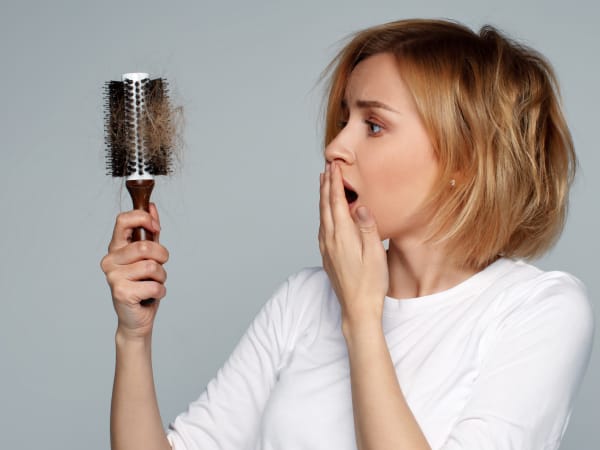 A young woman with pattern baldness looks shocked at the amount of lost hair caught in her hairbrush