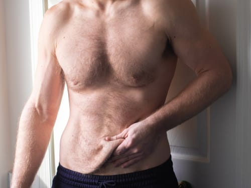 A slim man holding folds of loose belly skin after losing large amounts of weight