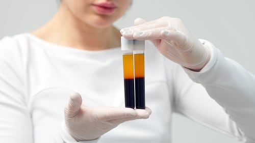 A gloved clinician holds two centrifuged test tubes showing distinct layers: a dark red layer of Red Blood Cells at the bottom, a thin, light buffy coat layer in the middle (containing white blood cells and platelets), and a clear yellow layer of plasma on top.