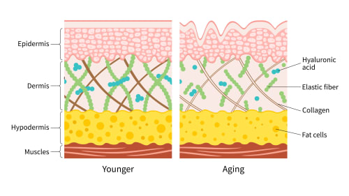 Comparative diagram showing the structure of Younger Skin versus Aging Skin. Younger skin has a tight, organized network of Collagen and Elastic fibres and high Hyaluronic Acid content in the Dermis, while Aging skin shows fragmented fibres, reduced Hyaluronic Acid, and thinning of the Dermis.
