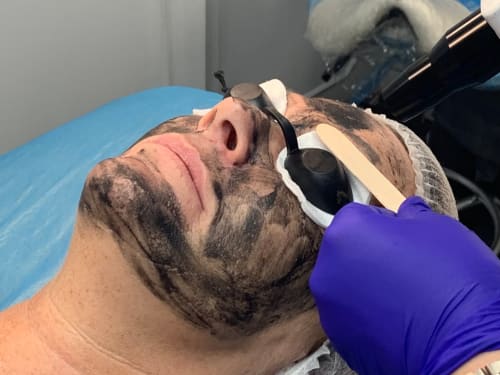 Skin Care & Facials in Rotherham