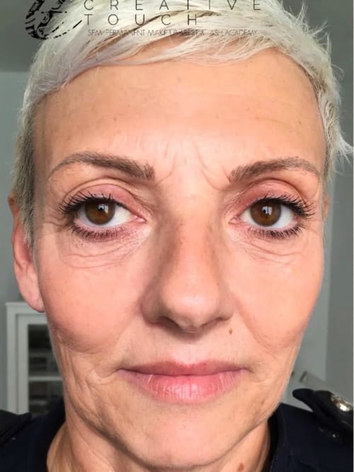 Before Oxygen Therapy treatment