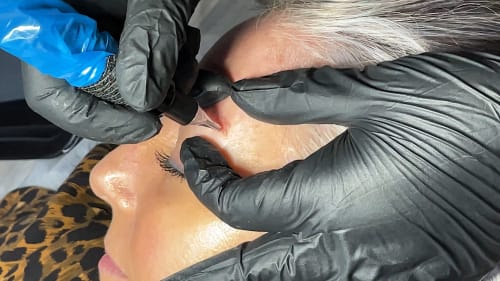 Close-up image of a saline eyebrow tattoo removal procedure. A small tool touches the eyebrow area as pigment is extracted.