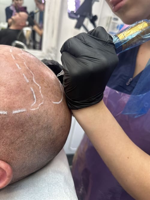 Grace Bayliss inking a client's scalp for a 'shaved head' look showing that even with no hair the precise dots of pigment look like realistic hair follicles.