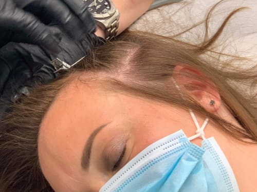 Checking a client's scalp ready for adding PMU pigmentation to improve the perceived hair density