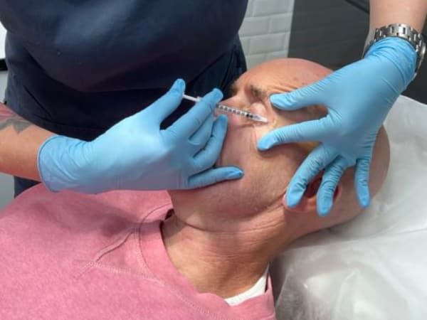 Zoe Bayliss administering Botox injection to remove Crow's feet wrinkles around the eyes